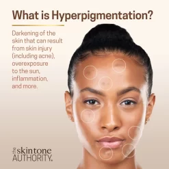 AMBI EVEN & CLEAR INTENSE CLARIFYING TONER 8oz -Cheap Wig Shop abmi even and clear intense clarifying toner 02