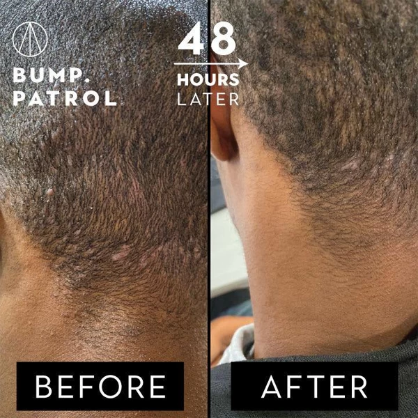 Bump Patrol Aftershave Treatment - Sensitive 2 Bump Patrol Aftershave Treatment - Sensitive - Image 2